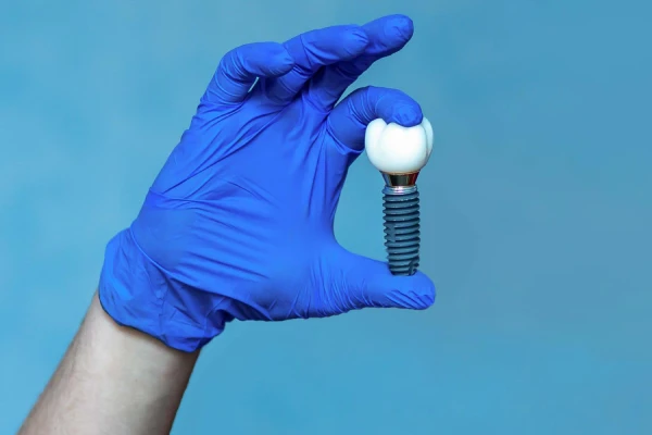 Mavi eldivenli el, porselen kronlu diş implantını mavi fonda tutuyor.